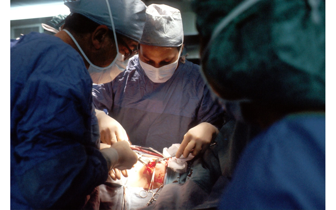 100NO 445: Does organ removal impact longevity?